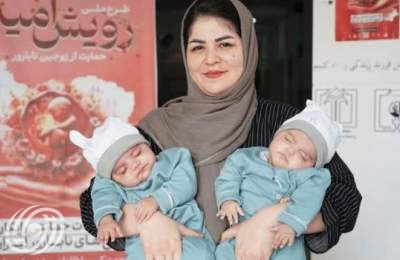 ولادة توأم مُجمَّد في شمال ايران بعد 6 سنوات من التجميد