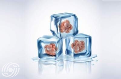 تجميد البويضات: طريقة للحفاظ على خصوبة المرأة