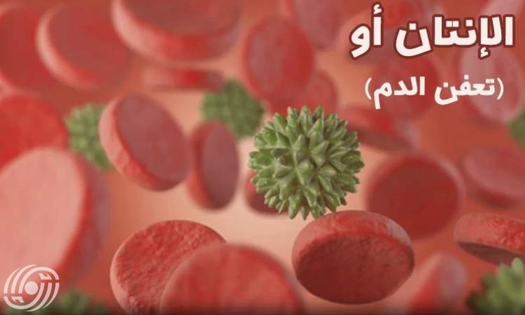 جامعة طهران..أمل جديد للتشخيص المبكر للإنتان