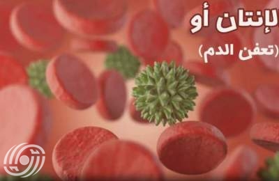 جامعة طهران..أمل جديد للتشخيص المبكر للإنتان