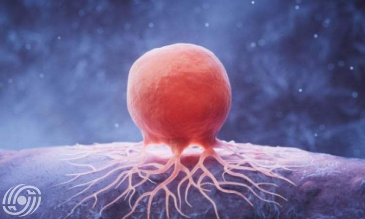 إيران تنتج أحد أكثر أدوية سرطان الدم تعقيدا