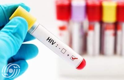 تحول أنماط انتقال فيروس نقص المناعة البشرية