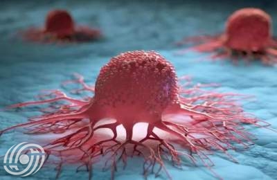 توطين صنع أدوات تشخيص وعلاج السرطان على يد باحثين إيرانيين