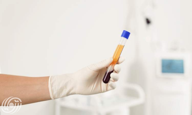 انطلاق المؤتمر الإيراني الثاني للبلازما الطبية