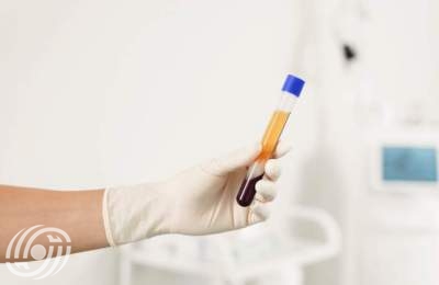 انطلاق المؤتمر الإيراني الثاني للبلازما الطبية